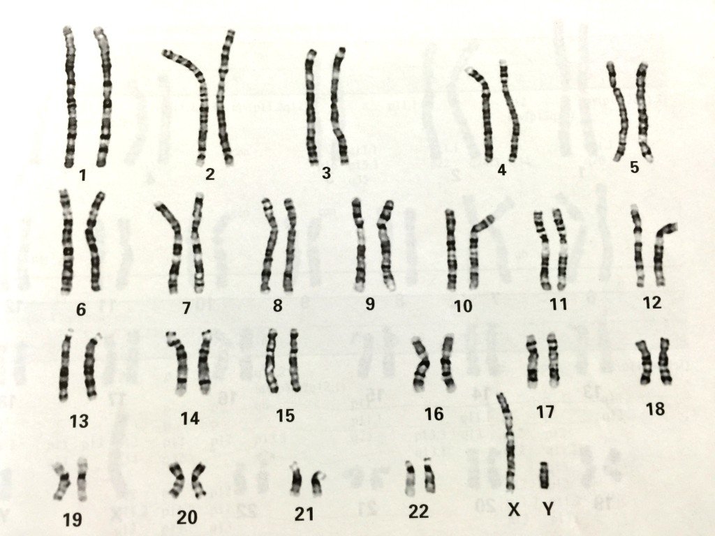 Chromosomes | Online Genetic Counselling